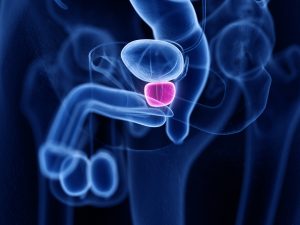 Infiammazione alla prostata e infertilità maschile - Prof. Filicori